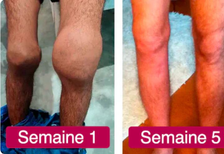 Crème Perfectx