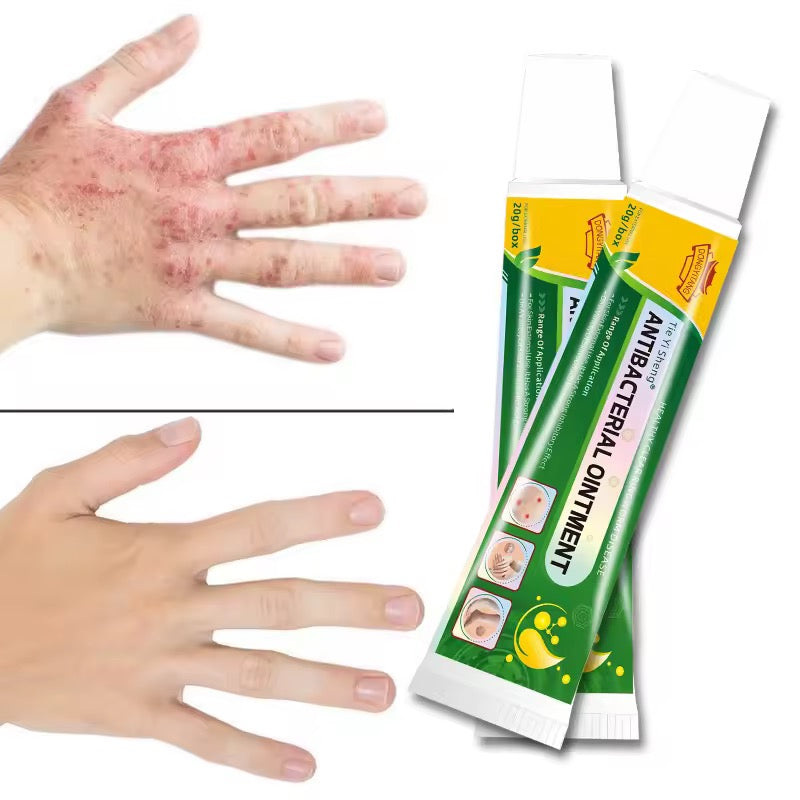 Pommade Antibactérienne - Eczéma